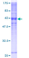 12.5% SDS-PAGE Stained with Coomassie Blue.